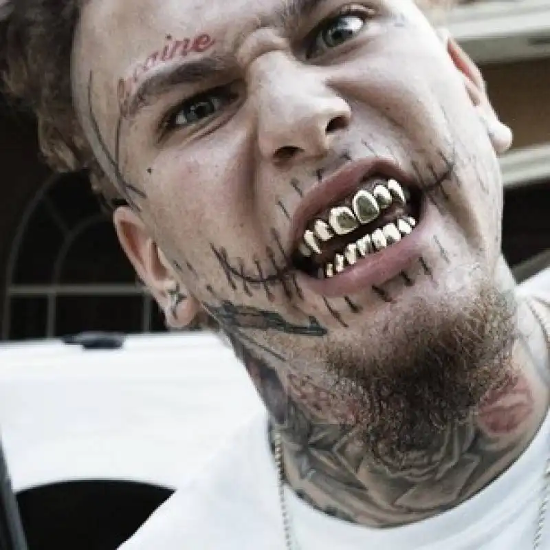 rapper stitches  10483360 1511606599109571 139267634 a