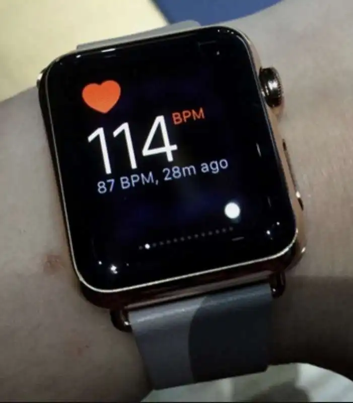 l'apple watch ti salva la vita 12