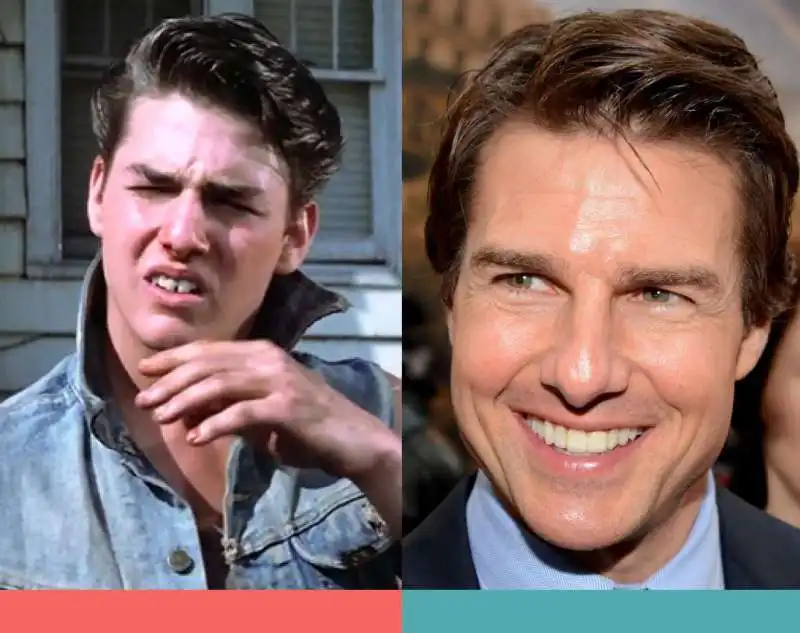 la trasformazione dei denti di tom cruise