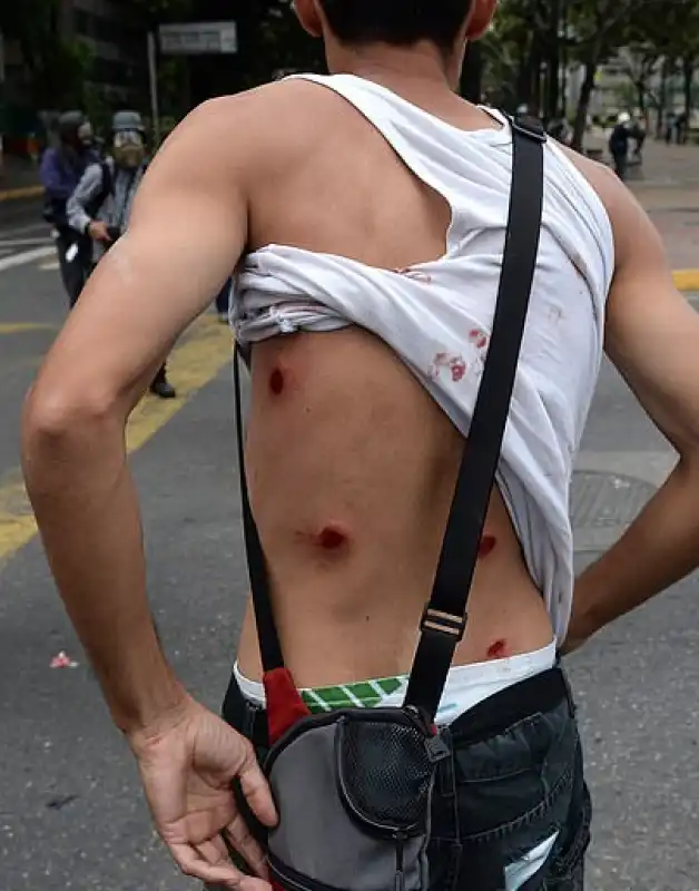 VENEZUELA PROTESTA 1