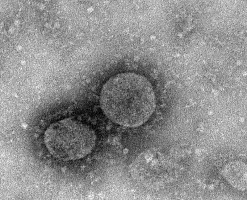 coronavirus al microscopio 3