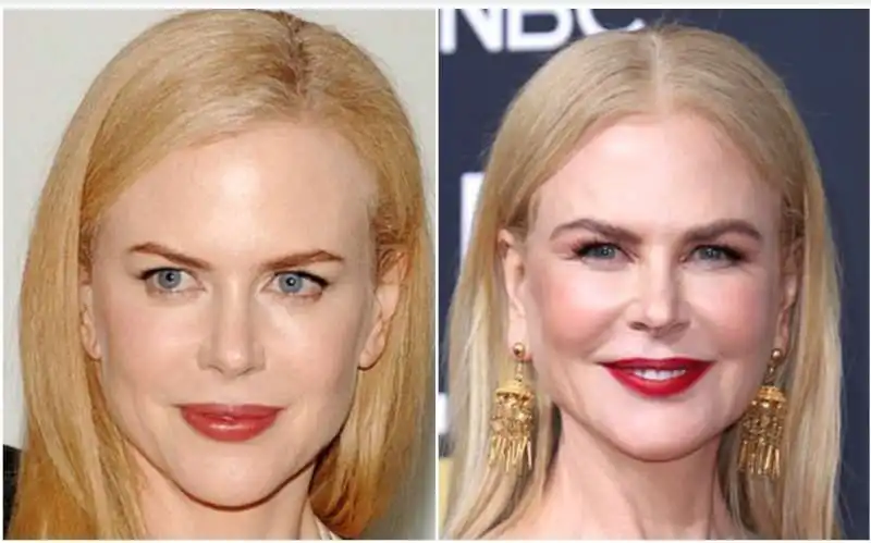 Nicole Kidman