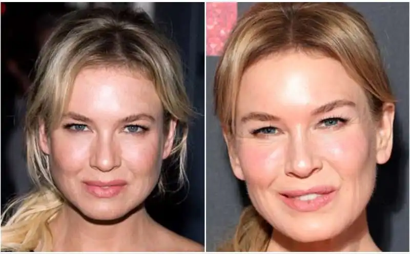 renee zellweger