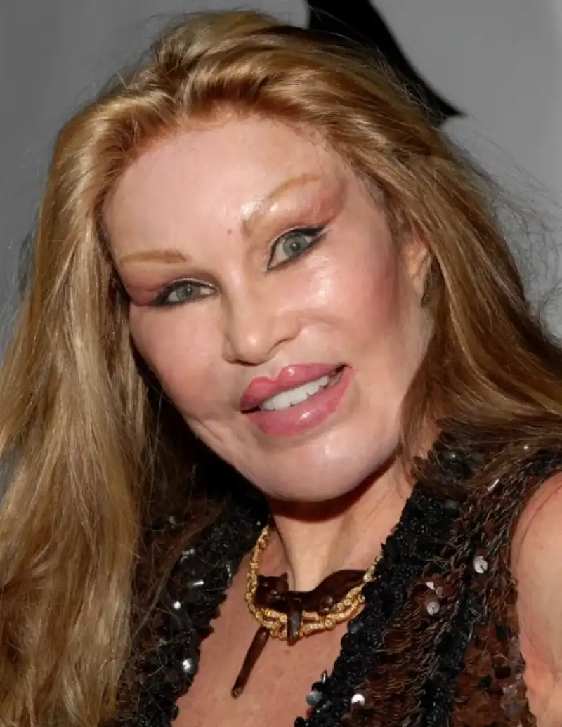 jocelyn wildenstein 11