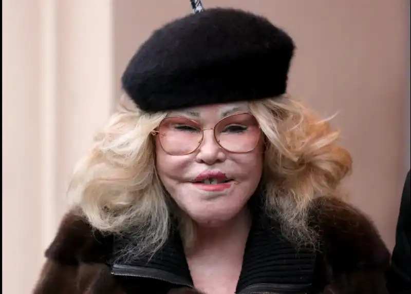 jocelyn wildenstein 3