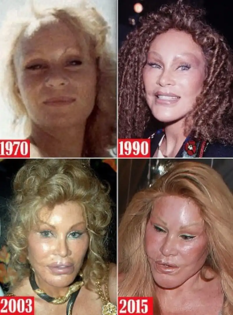 jocelyn wildenstein 9