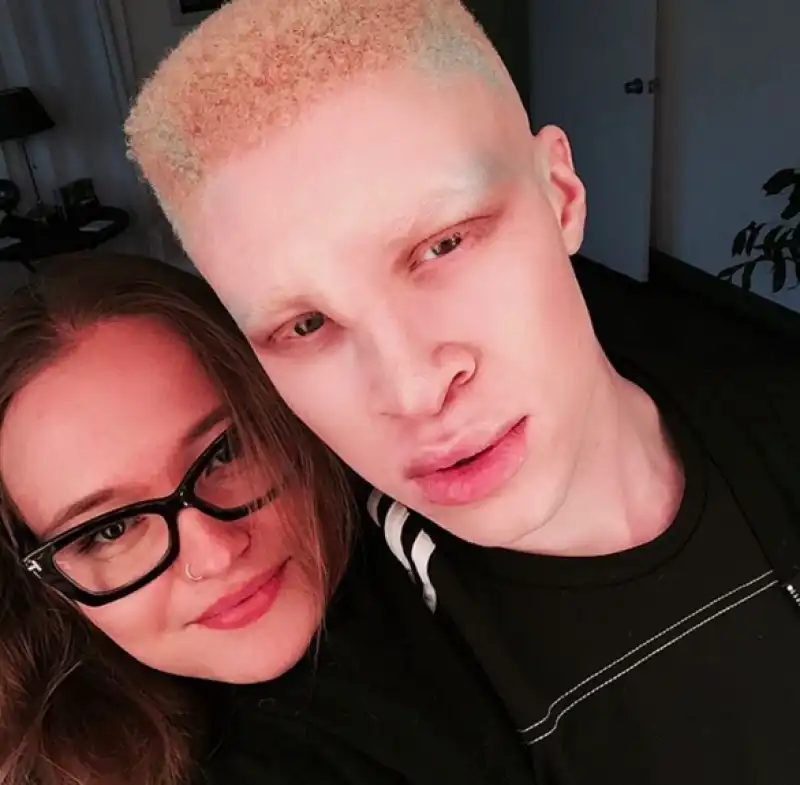 albini shaun ross