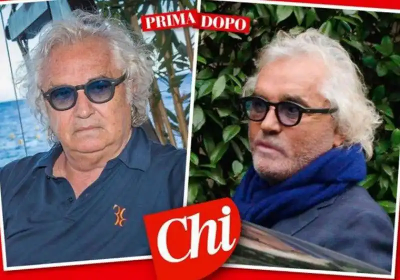 briatore prima e dopo da chi