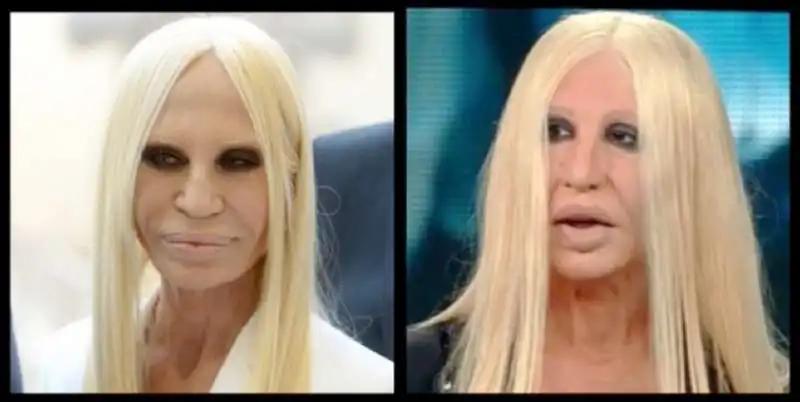 donatella versace virginia raffaele 