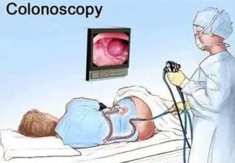 colonoscopy1