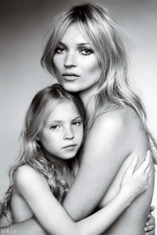 la figlia di kate moss senza dita