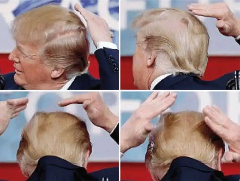 TRUMP E IL LAVORO DI RIPORTINO AI CAPELLI