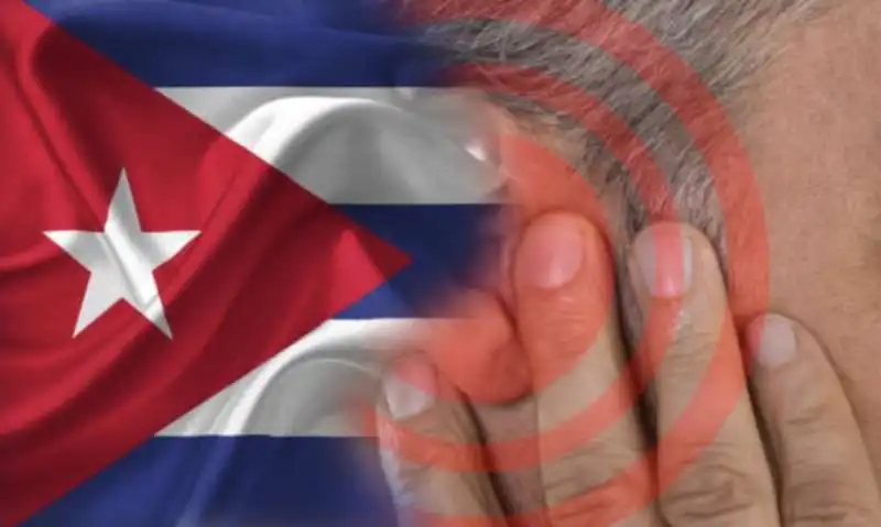 cuba attacchi acustici