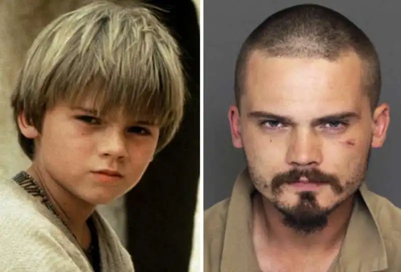 jake lloyd prima e dopo