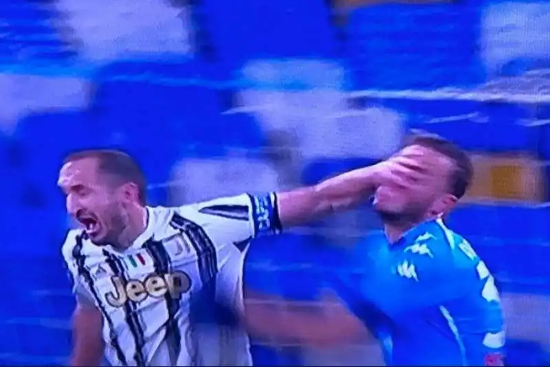 la manata di chiellini in napoli juventus