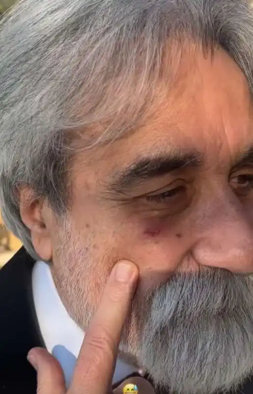 beppe vessicchio e l occhio nero 2023sanremo