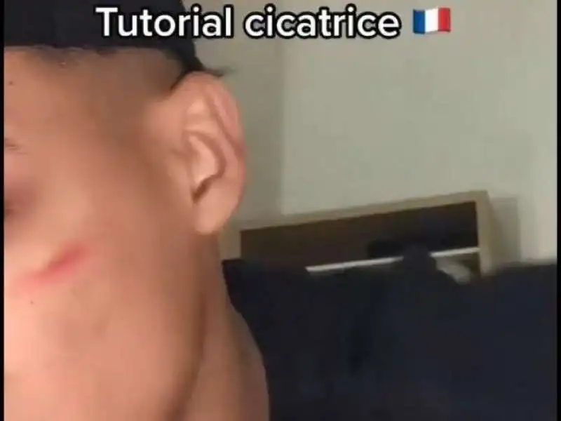 cicatrice fracese su tiktok 4