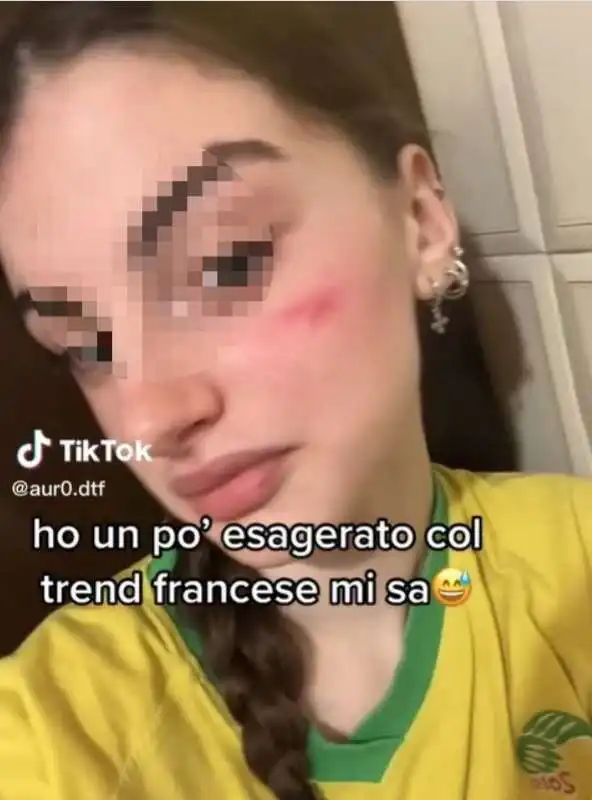 cicatrice fracese su tiktok 9