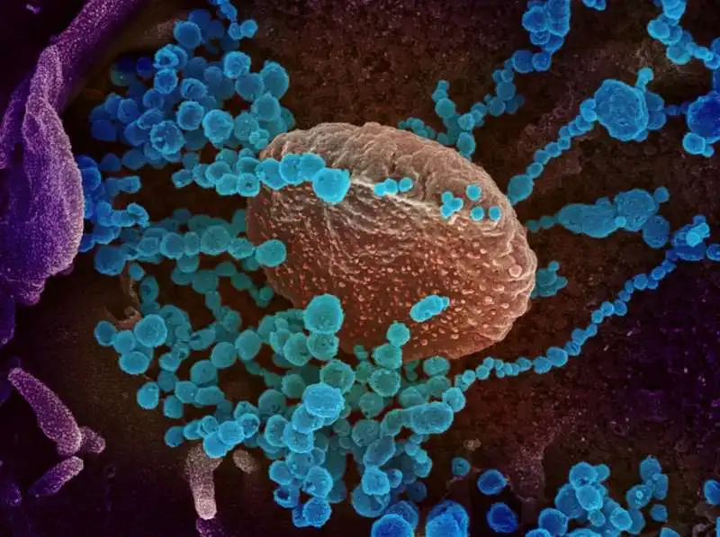 coronavirus al microscopio 2