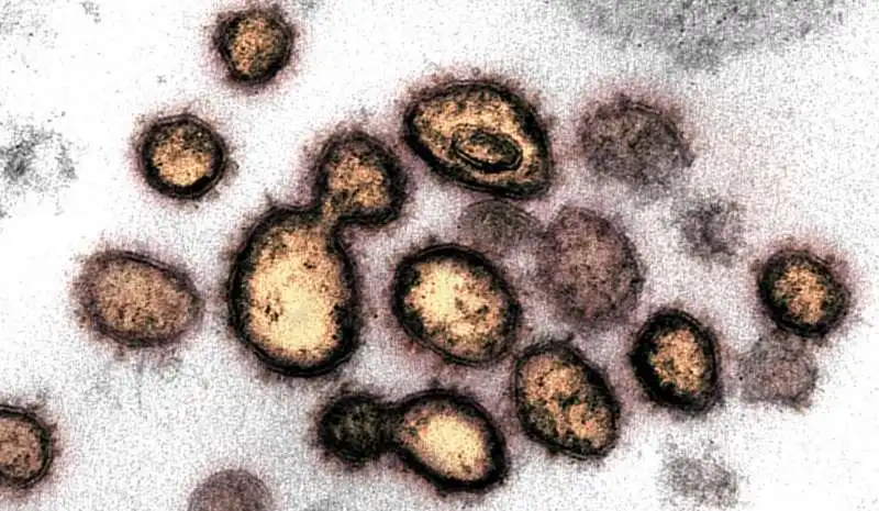 coronavirus al microscopio 5