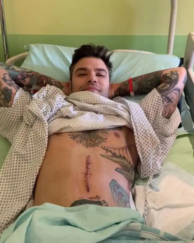 fedez 1