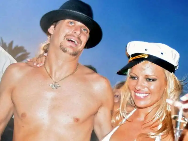 kid rock e pamela anderson  