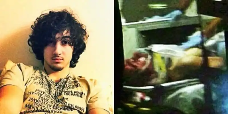 Dzhokar Tsarnaev in ospedale 