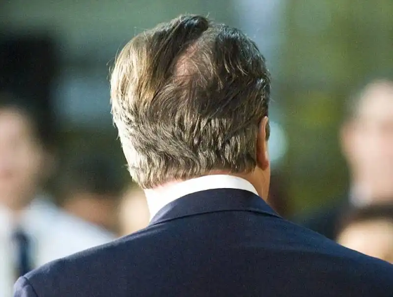 david cameron nasconde la chierica e si tinge i capelli