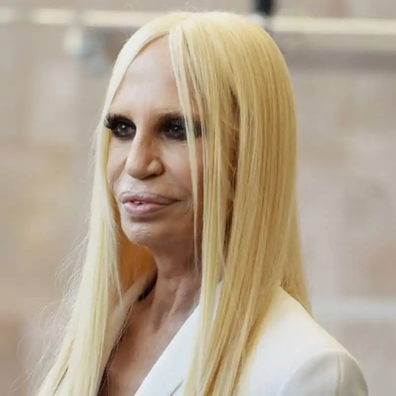 donatella versace cosmetic surgery after pictures botox face extreme makeover anna wintour costume centre