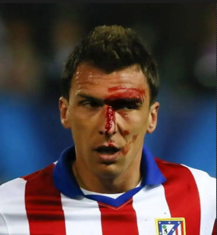 mandzukic