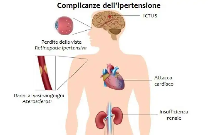 complicanze dell ipertensione