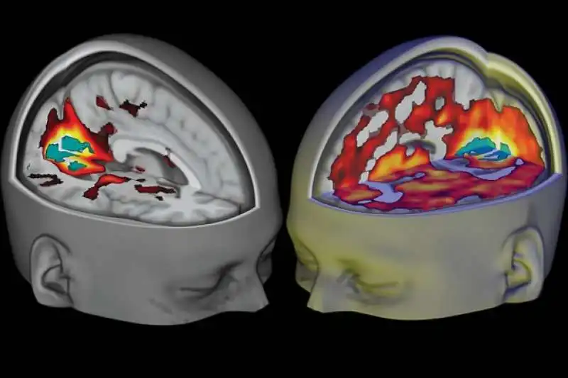 GLI EFFETTI DELLE DROGHE PSICHEDELICHE SUL CERVELLO 