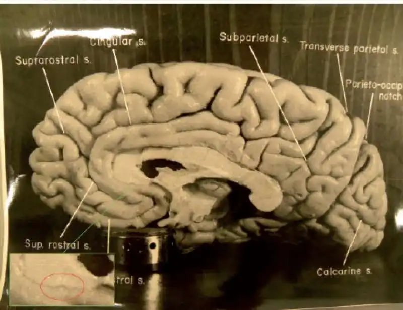 il cervello di einstein sotto osservazione