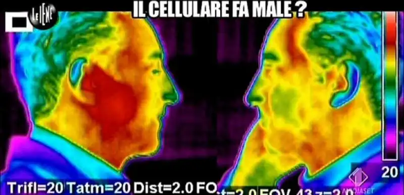 TELEFONINI E TUMORE AL CERVELLO   