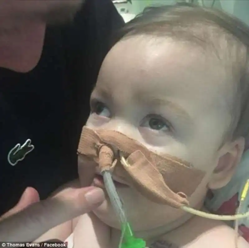 alfie evans 3