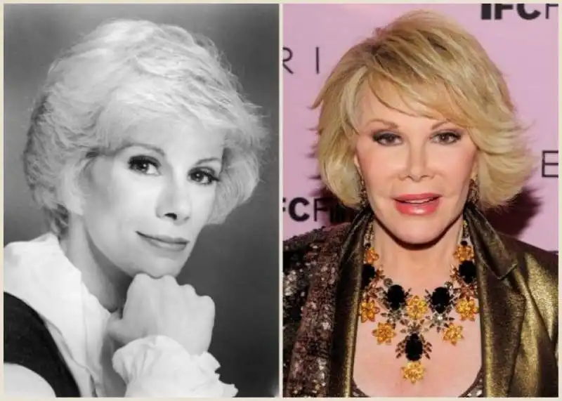 joan rivers