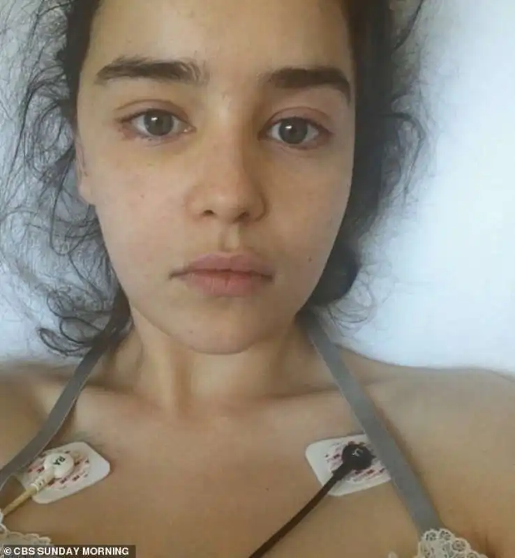 le foto di emilia clarke in ospedale dopo l'aneurisma 3