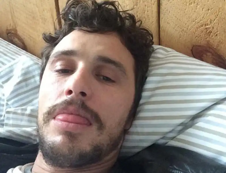 James Franco al risveglio 