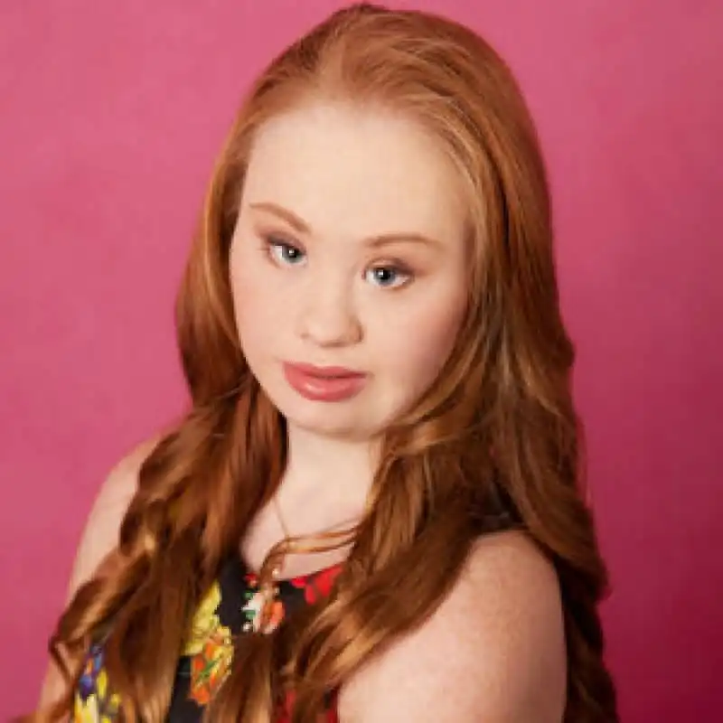 madeline stuart model down syndrome