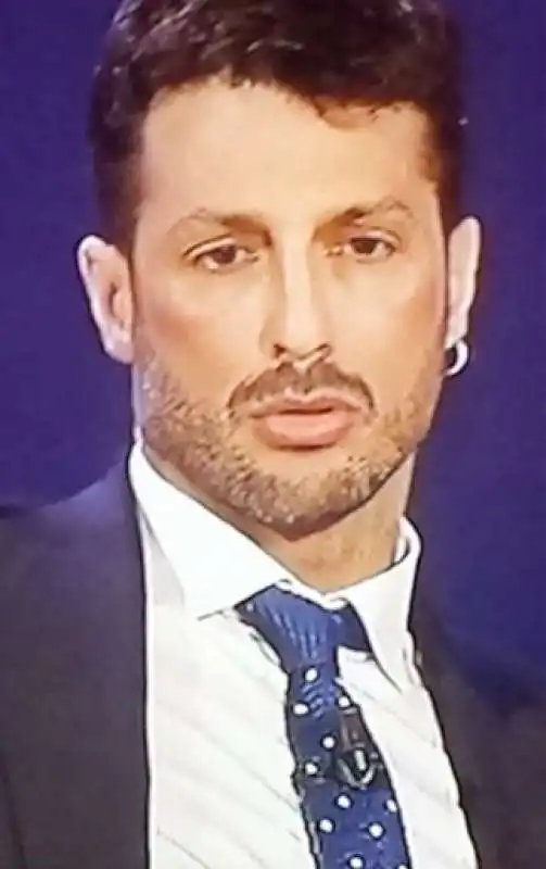 fabrizio corona in preda al botox