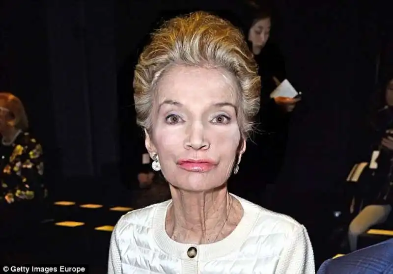 lee radziwill sorella di jackie