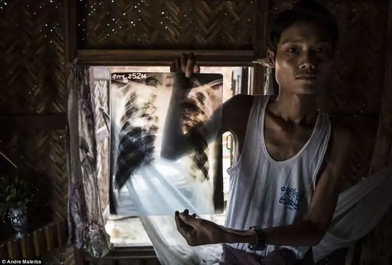 myanmar ko maw gyi un ex lavoratore nelle minerie