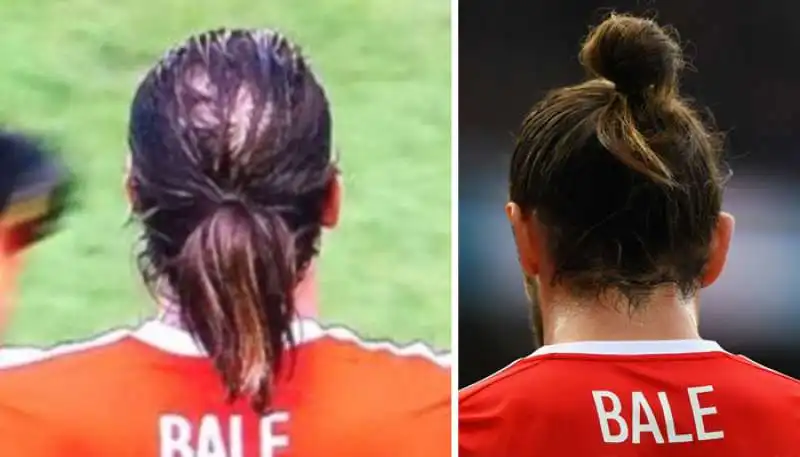 gareth bale e lo chignon anti calvizie