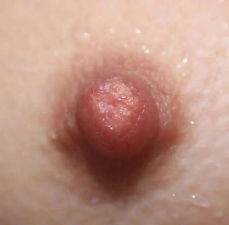 genderless nipples 1