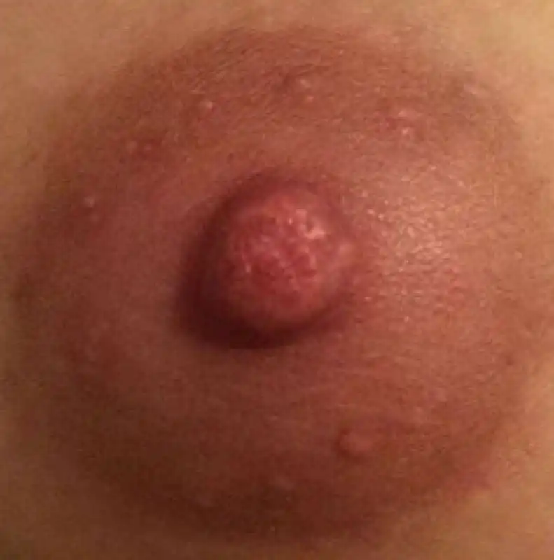 genderless nipples 7