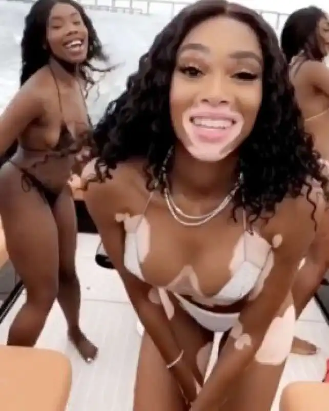 winnie harlow 17