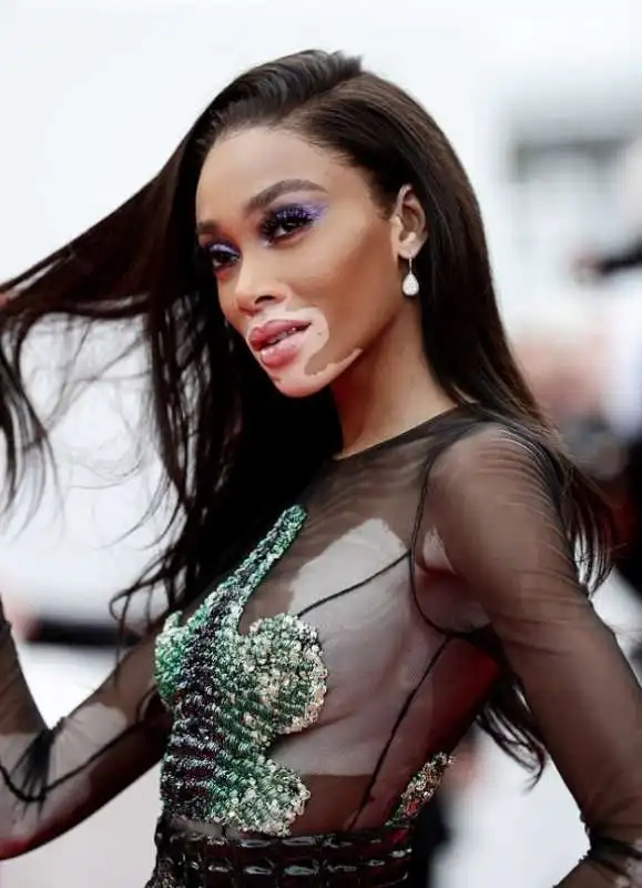 winnie harlow 23