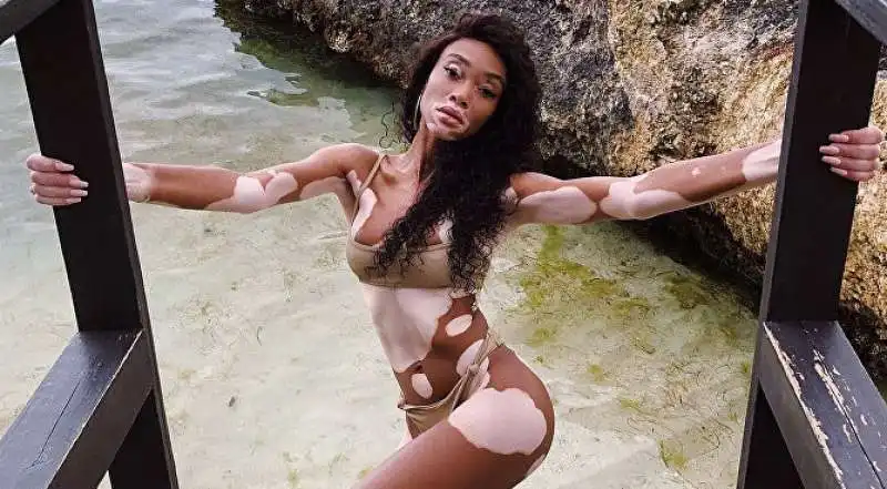 winnie harlow 28