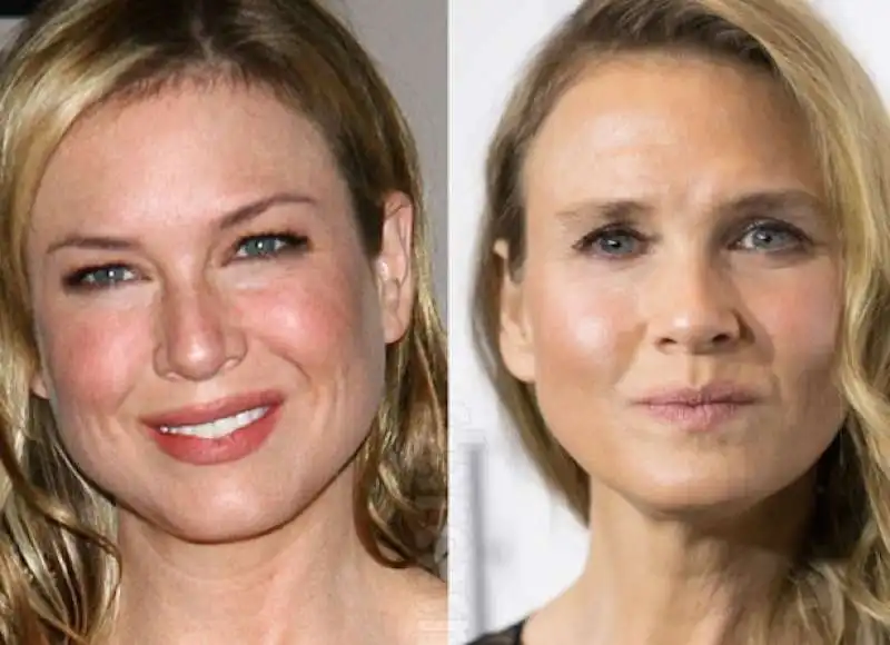  renee zellweger