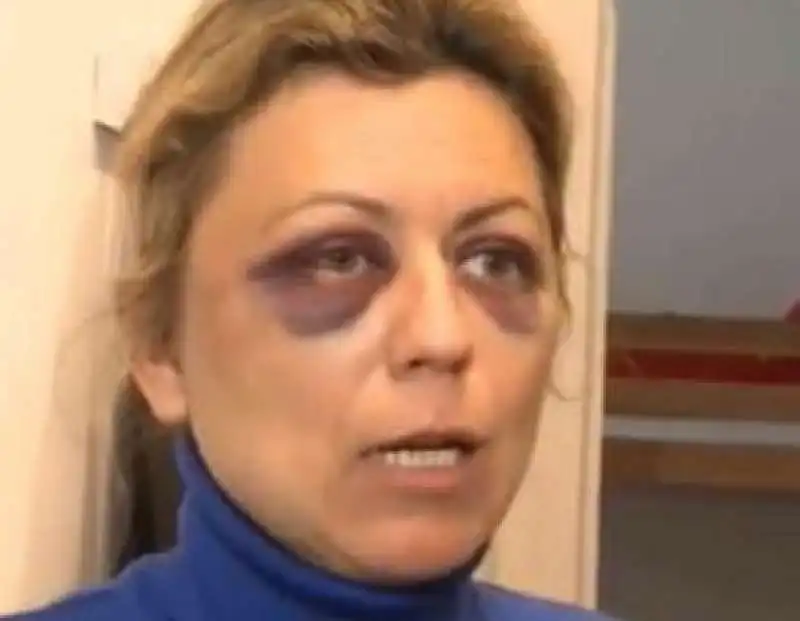 la dottoressa aggredita in via washington a milano   3